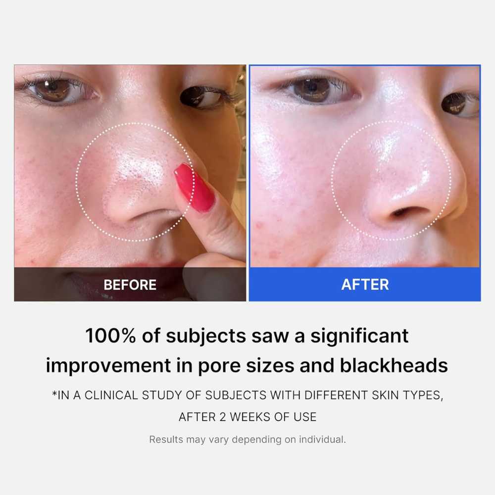 Medicube Zero Pore Pad 155g 70 pads