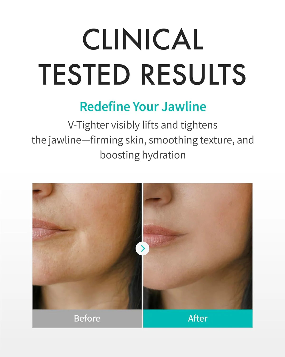 Rejuran Healer Perfect Healing V Tighter