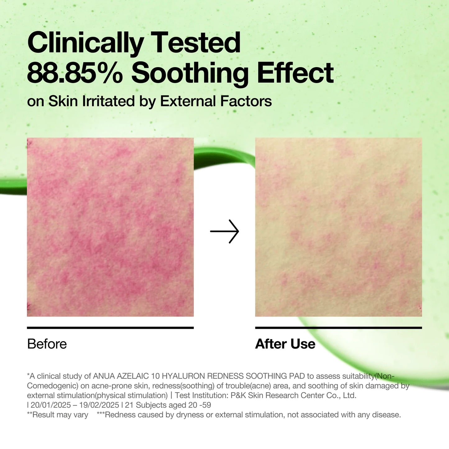 ANUA Azelaic 10 Hyaluron Redness Soothing Pad 60 Pads